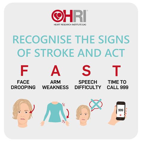 traduction stroke|medical stroke in french.